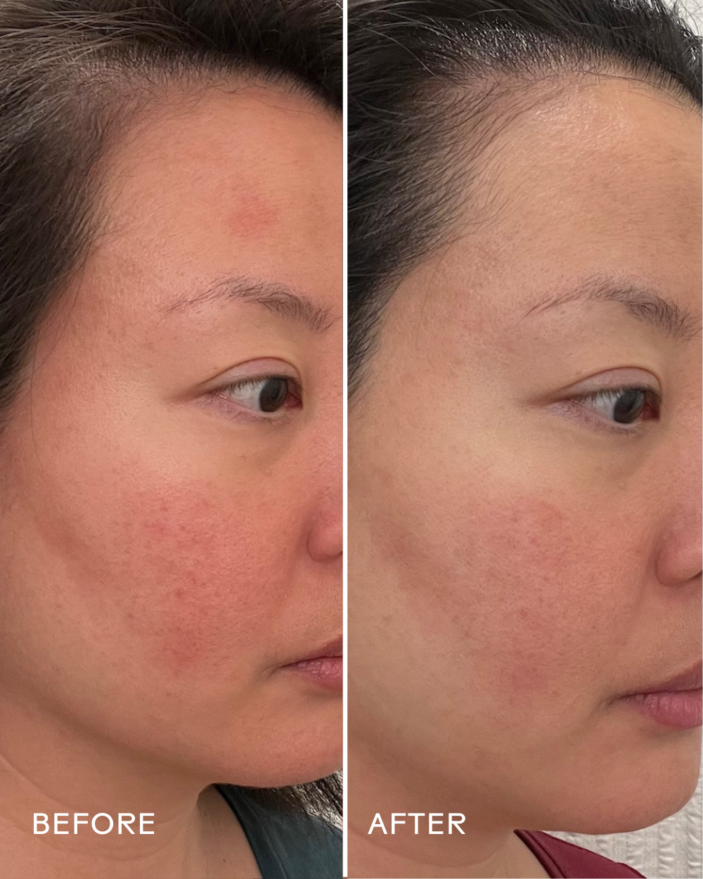 NovaDerm Sérum Visage - Sérum Barrière Céramides Myrtille by Three Ships (No Duties | Ships from US/CA | USMCA Compliant)